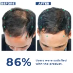 DHTLAB™ Science-Backed Multi-Peptide DHT Blocker & Hair Growth Serum - Image 10