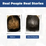 DHTLAB™ Science-Backed Multi-Peptide DHT Blocker & Hair Growth Serum - Image 7