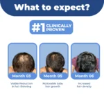 DHTLAB™ Science-Backed Multi-Peptide DHT Blocker & Hair Growth Serum - Image 11